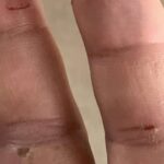 金魚の病気予報